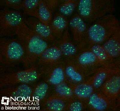 A431 cells were fixed for 10 minutes using 10% formalin and then permeabilized for 5 minutes using 1X PBS + 0.5% Triton-X100. The cells were incubated with 53BP1 Antibody at 2 ug/mL overnight at 4C and detected with an anti-rabbit Dylight 488 (Green) at a 1:500 dilution. Alpha tubulin (DM1A) NB100-690 was used as a co-stain at a 1:1000 dilution and detected with an anti-mouse Dylight 550 (Red) at a 1:500 dilution. Nuclei were counterstained with DAPI (Blue). Cells were imaged using a 40X objective.